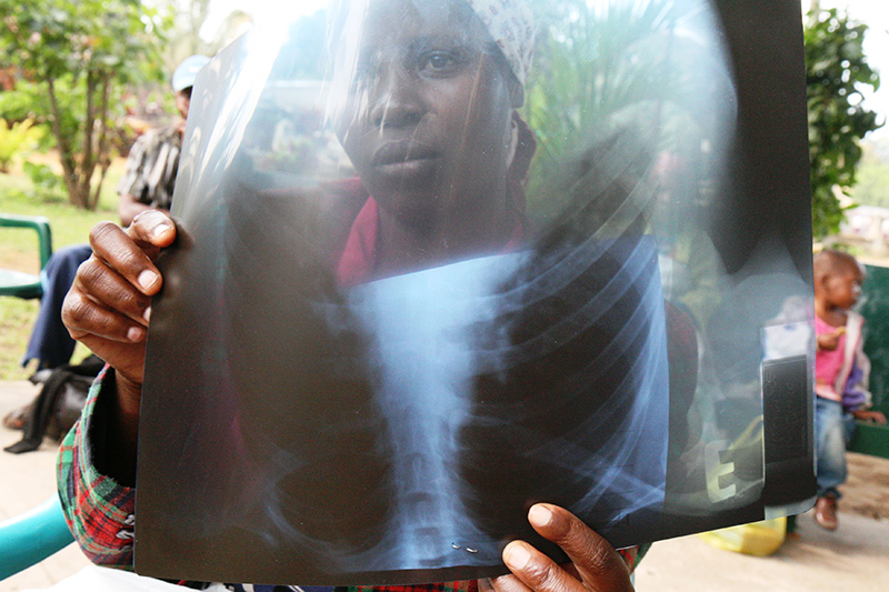 Una donna in attesa di una visita nel centro medico di Machava della Comunità di Sant'Egidio.